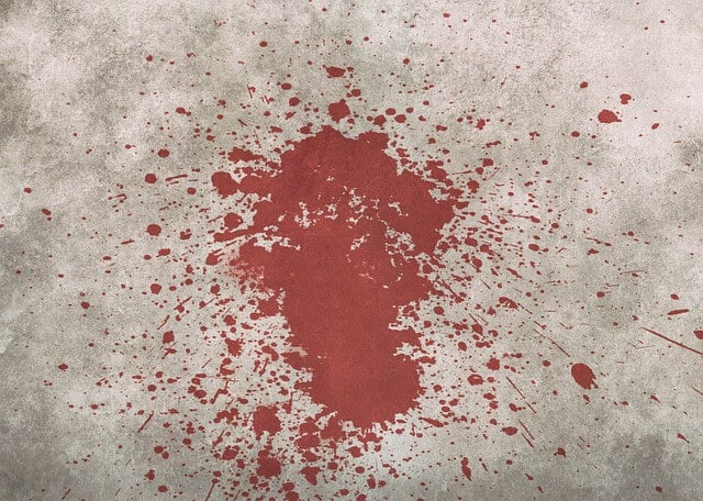 ניקוי כתמי דם